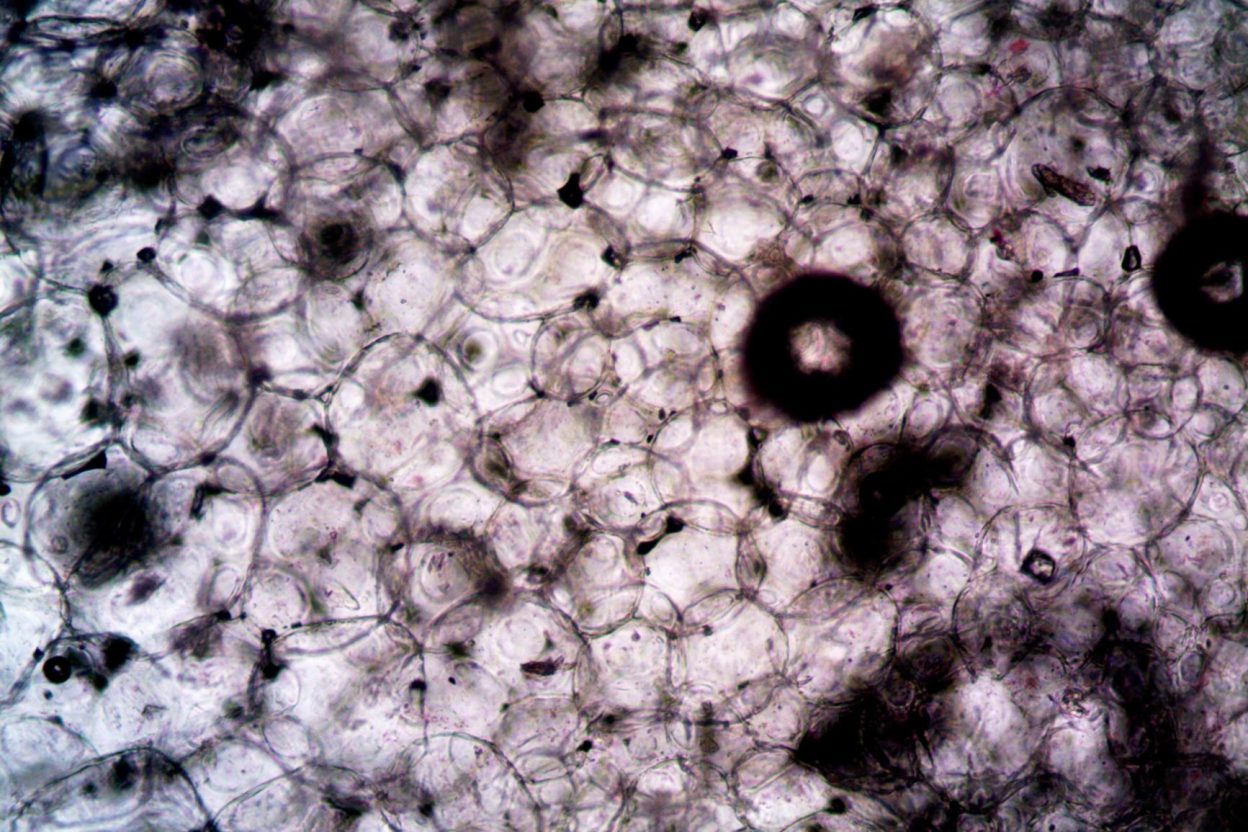 Cancer : une voie de survie cellulaire inconnue ouvre une piste de recherche, mais aucun traitement n’existe encore Une nouvelle voie de production de cystéine a été identifiée dans des cellules de mammifères
