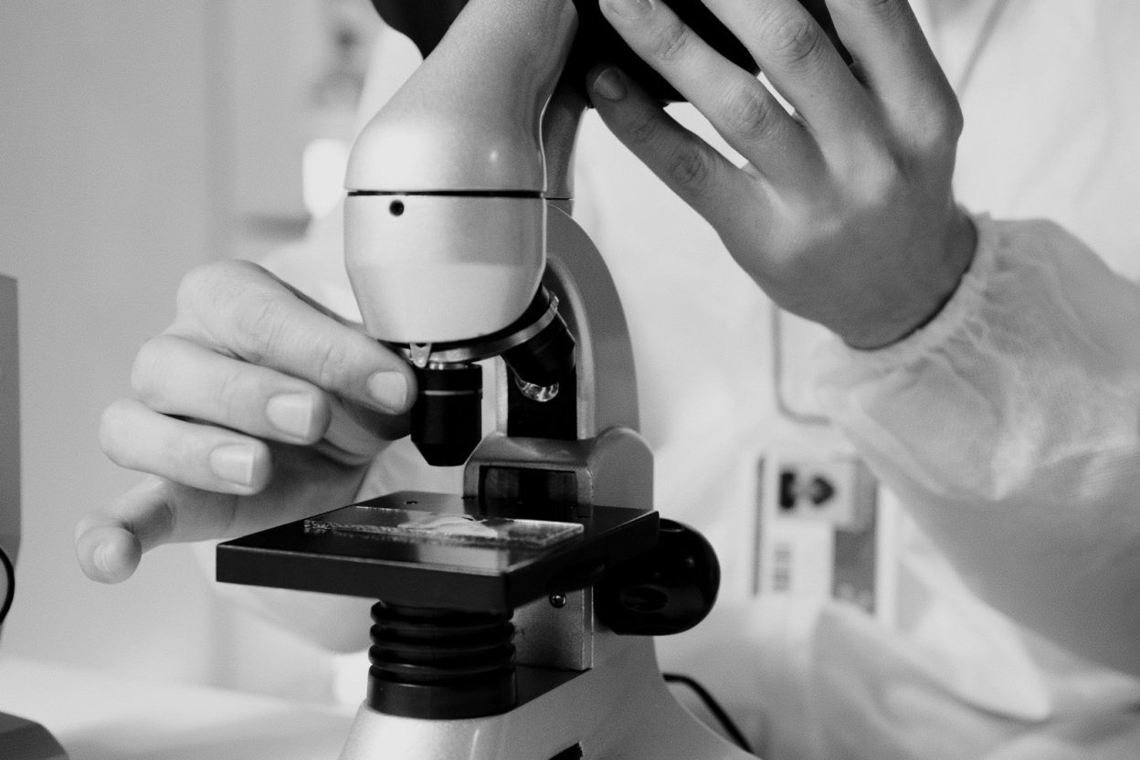 Des œufs de parasite forment une « queue » au laboratoire : le test qui a éclairci une crise neurologique Un examen cérébral a révélé des lésions chez une patiente atteinte de schistosomiase