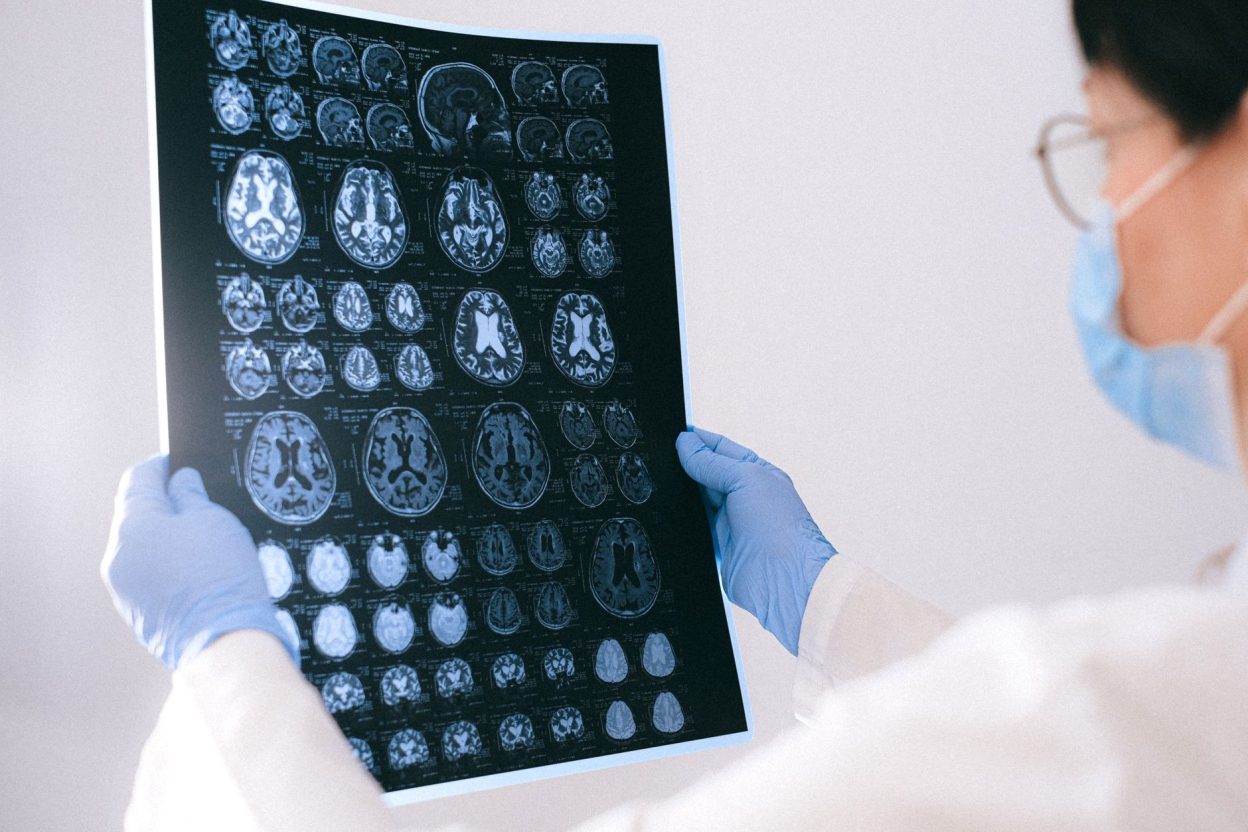 Une cellule corticale sur 1 000 : ces rares neurones ont réussi à déclencher le sommeil chez des souris De très rares neurones du cortex pourraient participer directement au déclenchement du sommeil