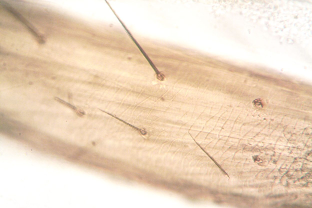 Surdité : des cellules découvertes chez le calmar ouvrent une nouvelle piste pour comprendre l’oreille humaine Les cellules ciliées du calmar pourraient aider à mieux comprendre les mécanismes de l’audition humaine